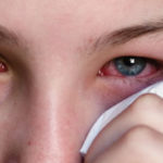 Аденовирусная инфекция глаз