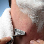Раздражение кожи после бритья