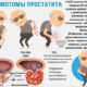 Признаки хронического простатита