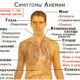 анемия симптомы
