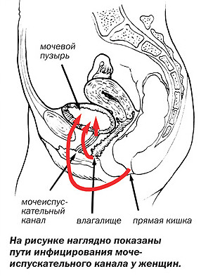 пути проникновения инфекции
