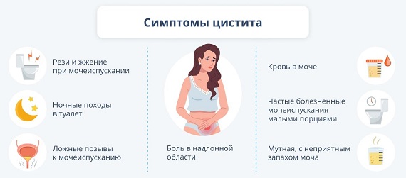 Симптомы цистита у женщин